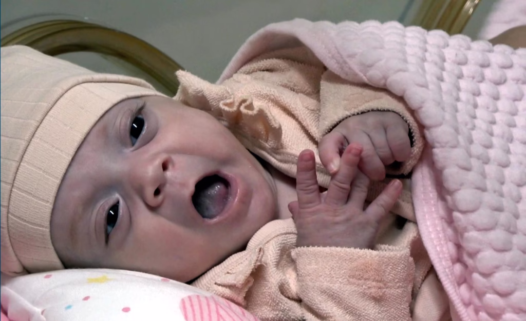 Ardahan’da 780 gram doğan Elfin bebek, 6 ay sonra taburcu edildi